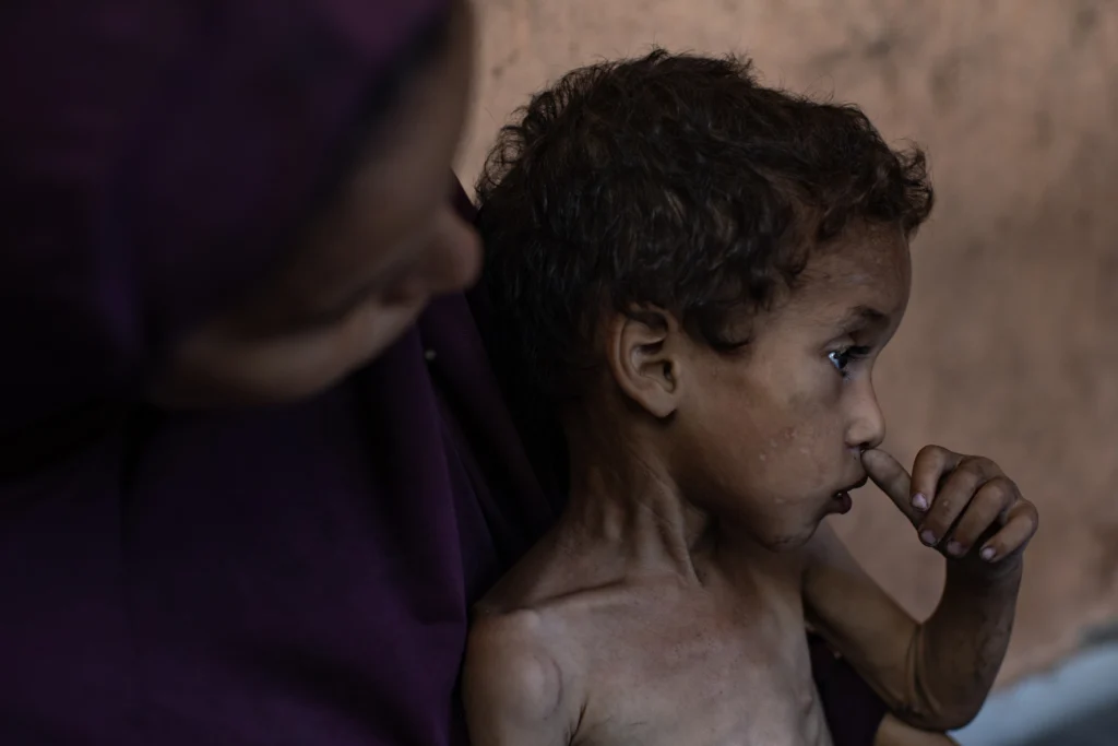 Hambruna en Gaza: "alimentos" que quitan la vida o el Holocausto del siglo XXI 2 eb5cae74d5b46dbc13e1aa9779faf4d774a4b991