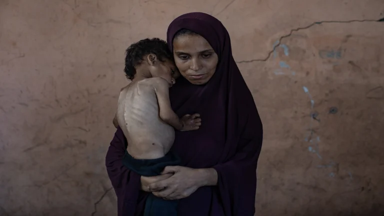 Hambruna en Gaza: cada día más niños mueren por desnutrición 1 f1e8e6a809a96e2528665bd2a7200de60887ca4d