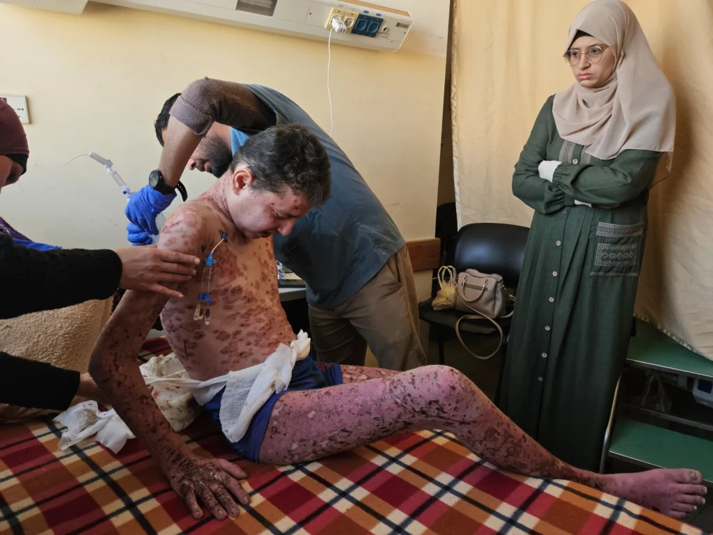 Muerte silenciosa: enfermedades infecciosas amenazan a los niños de Gaza 2 Muerte silenciosa: enfermedades infecciosas amenazan a los niños de Gaza
