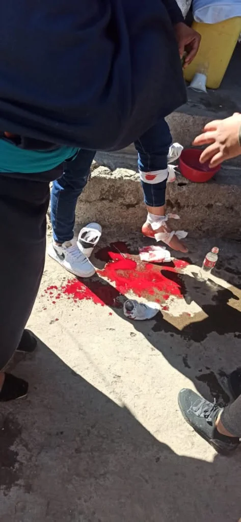 Minuto a minuto: denuncian represión con armas de fuego contra Paro Nacional 4 g1drhftxqaarygh 1
