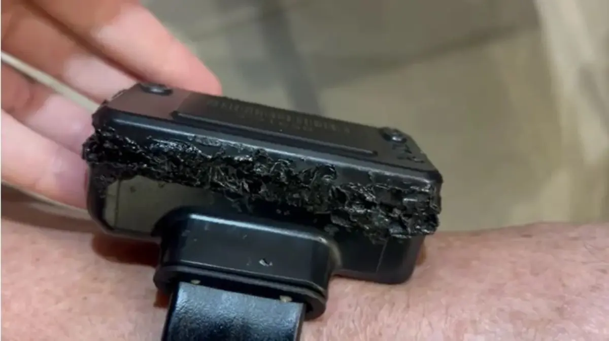 tobillera electronica bolsonaro danada nov25.jpg